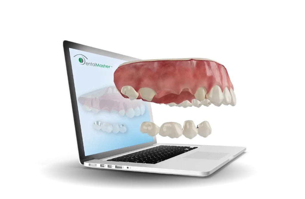 laptop with 3d dental model