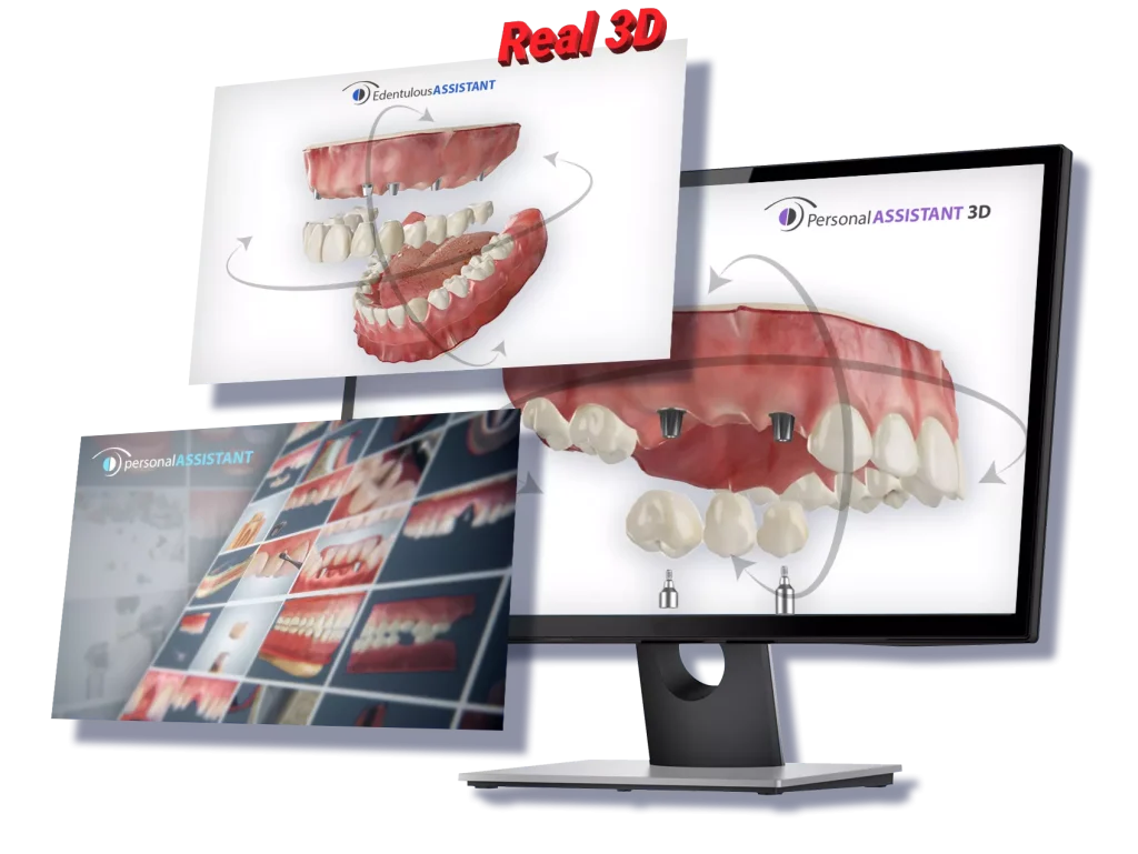 DentalMaster 3D bundle